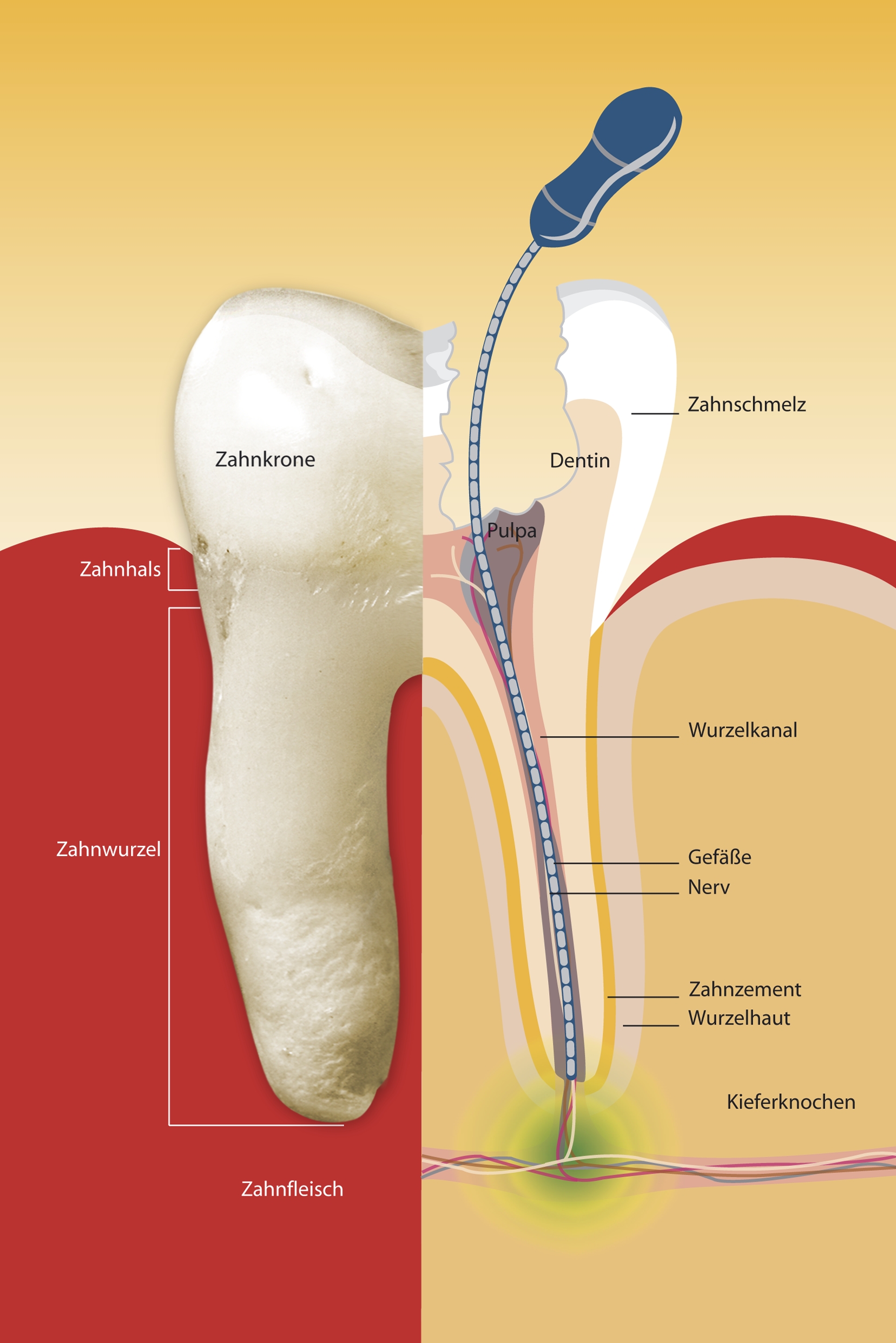 Wurzelkanalbehandlung – Endodontie